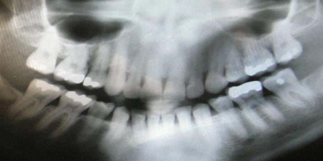 dental-1742892273-660x330