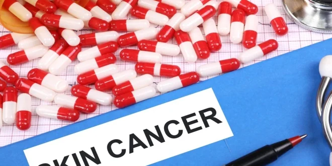 skin-cancer_large_1554_148.webp-e1752713498929-660x330