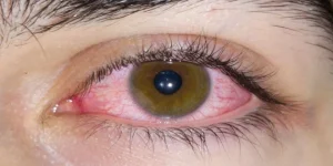 digital-eye-strain_large_1328_148.webp-e1754195781711-660x330